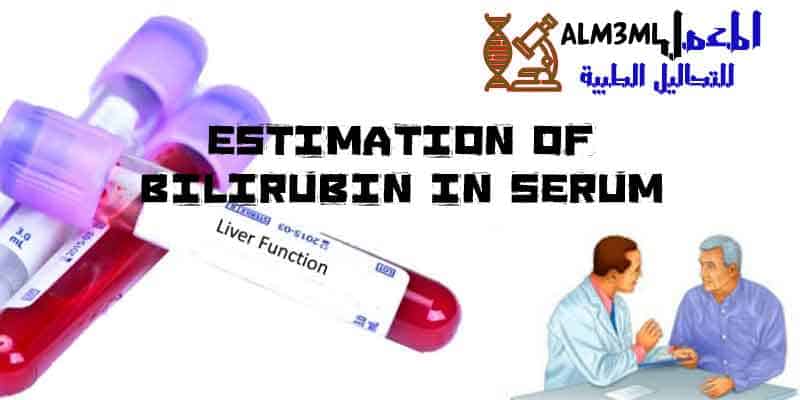 Estimation-of-Bilirubin-in-serum